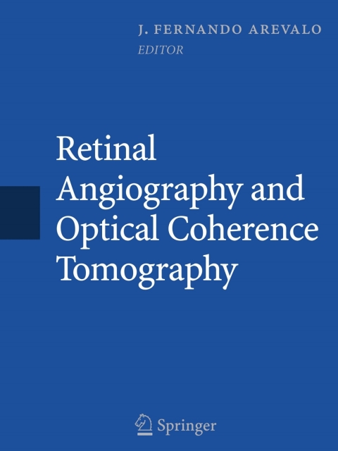 Cover image for book Retinal Angiography and Optical Coherence Tomography