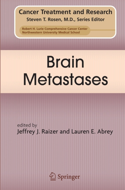 Cover image for book Brain Metastases