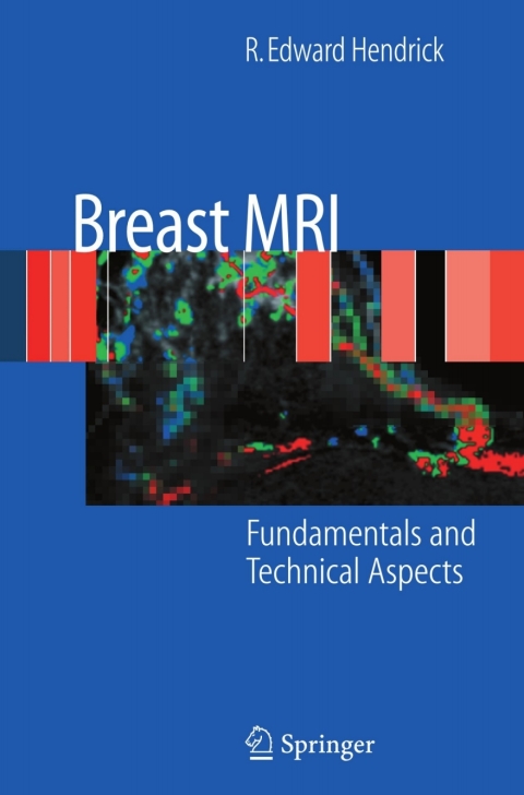 Cover image for book Breast MRI