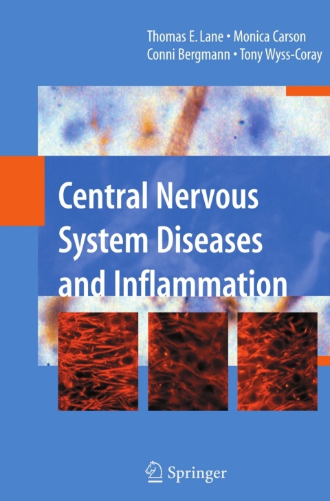 Central Nervous System Diseases and Inflammation 