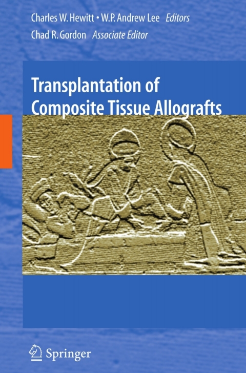 Cover image for book Transplantation of Composite Tissue Allografts