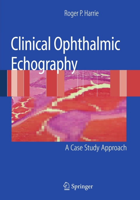 Cover image for book Clinical Ophthalmic Echography