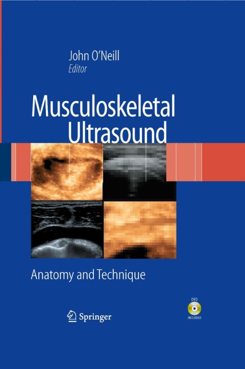 Cover image for book Musculoskeletal Ultrasound
