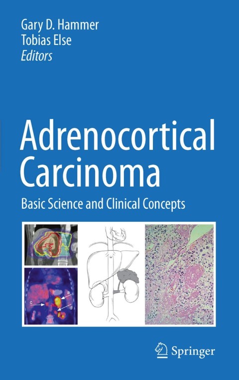 Cover image for book Adrenocortical Carcinoma