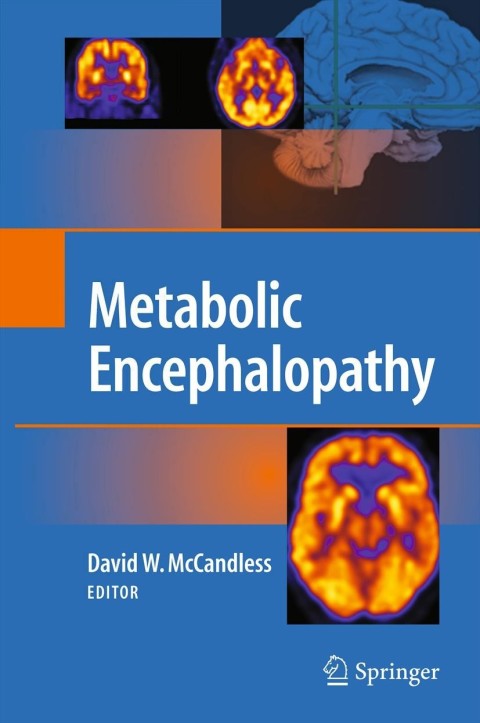 Cover image for book Metabolic Encephalopathy