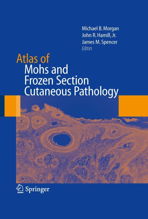Cover image for book Atlas of Mohs and Frozen Section Cutaneous Pathology