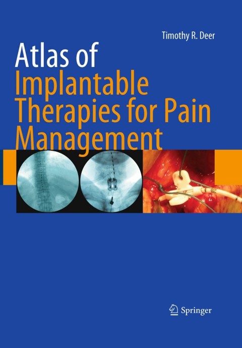Cover image for book Atlas of Implantable Therapies for Pain Management