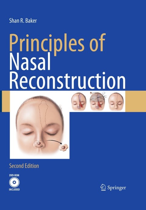 Cover image for book Principles of Nasal Reconstruction