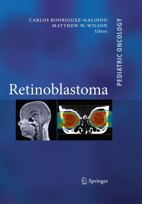 Retinoblastoma 