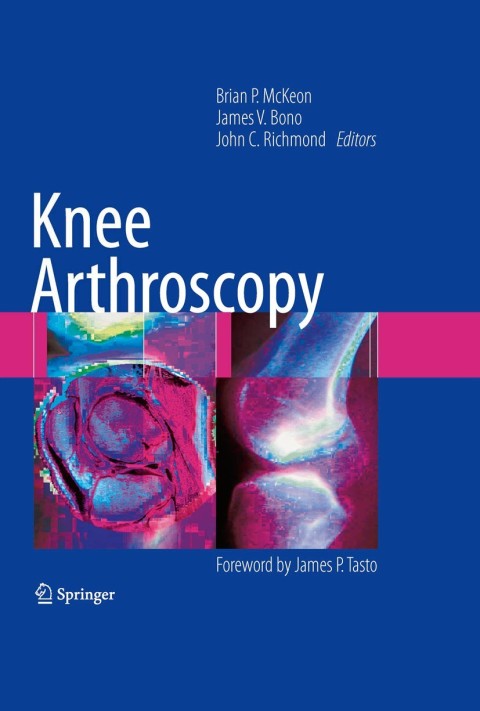 Cover image for book Knee Arthroscopy
