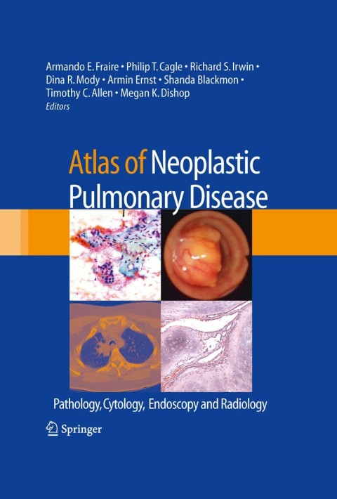 Cover image for book Atlas of Neoplastic Pulmonary Disease