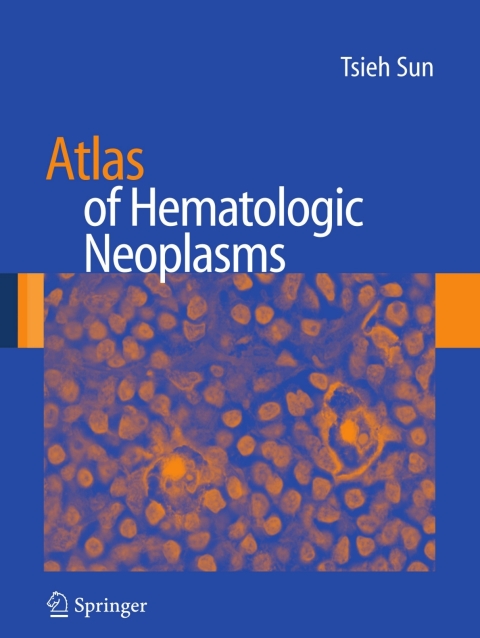 Cover image for book Atlas of Hematologic Neoplasms
