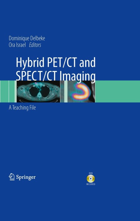 Cover image for book Hybrid PET/CT and SPECT/CT Imaging