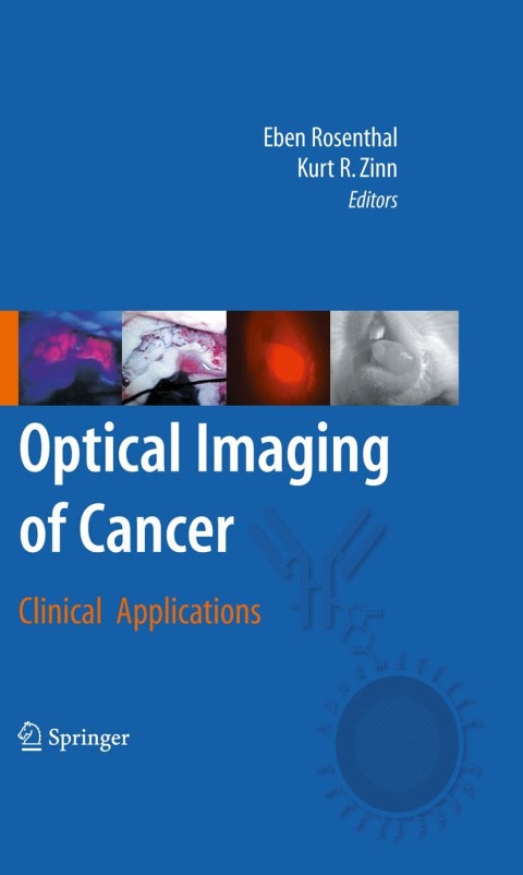 Cover image for book Optical Imaging of Cancer