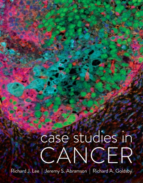 Cover image for book Case Studies in Cancer