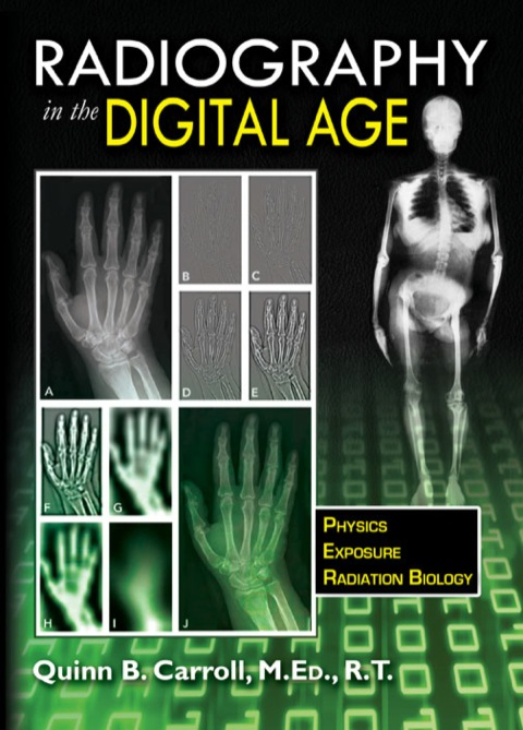 Cover image for book Radiography in the Digital Age: Physics-Exposure-Radiation Biology