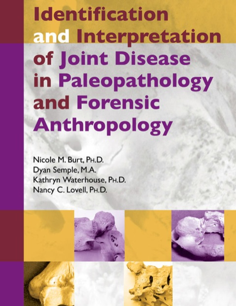 Cover image for book Identification And Interpretation Of Joint Disease In Paleopathology And Forensic Anthropology
