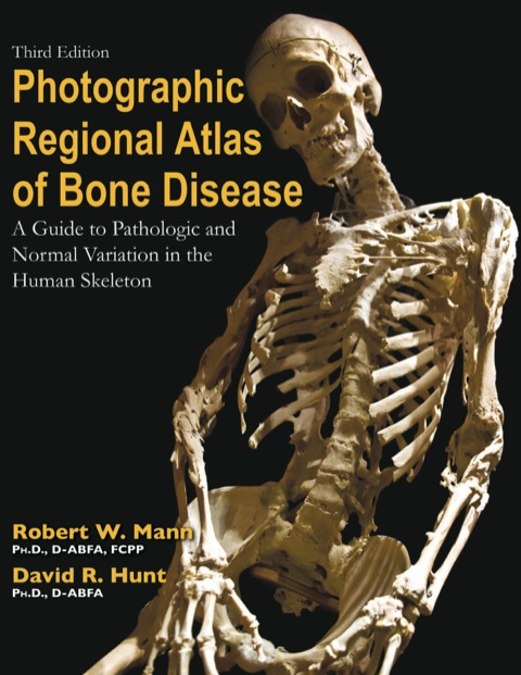 Cover image for book Photographic Regional Atlas of Bone Disease: "A Guide to Pathologic and Normal Variationin the Human Skeleton"
