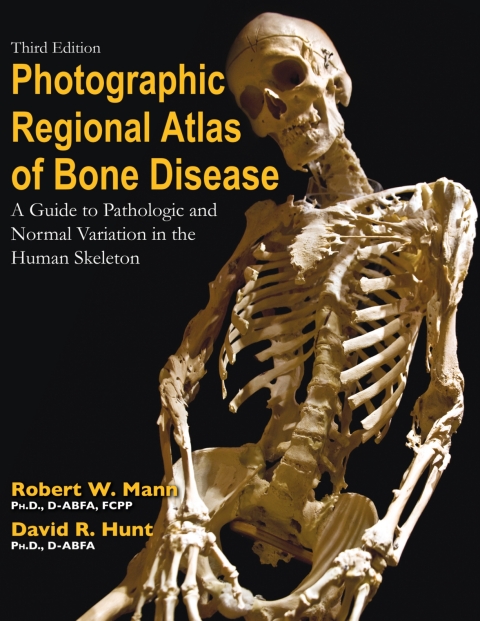 Cover image for book Photographic Regional Atlas of Bone Disease: A Guide to Pathologic and Normal Variation in the Human Skeleton