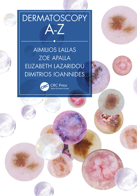 Cover image for book Dermatoscopy A-Z