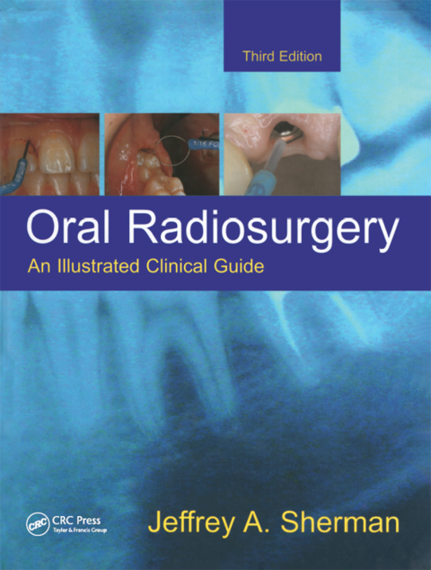 Cover image for book Oral Radiosurgery