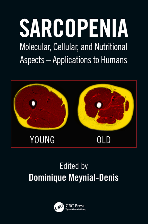 Cover image for book Sarcopenia