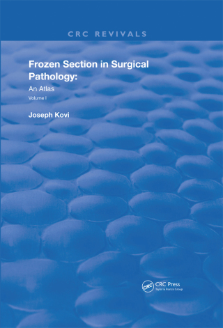 Frozen Section in Surgical Pathology