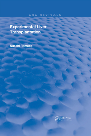 Experimental Liver Transplantation