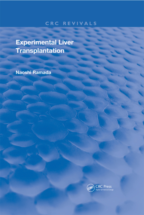 Cover image for book Experimental Liver Transplantation