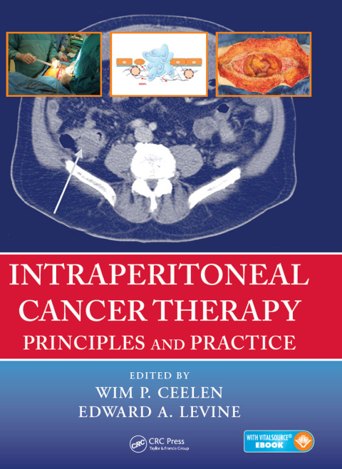Cover image for book Intraperitoneal Cancer Therapy