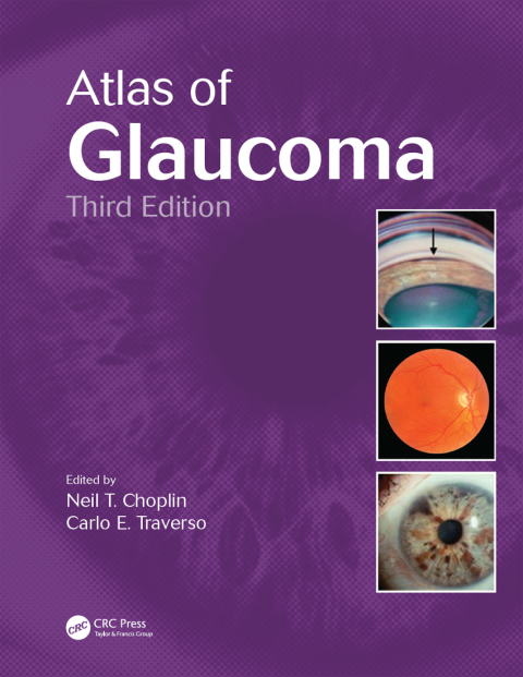 Cover image for book Atlas of Glaucoma