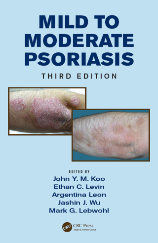 Mild to Moderate Psoriasis