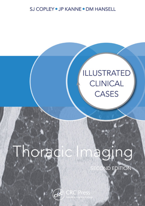 Cover image for book Thoracic Imaging