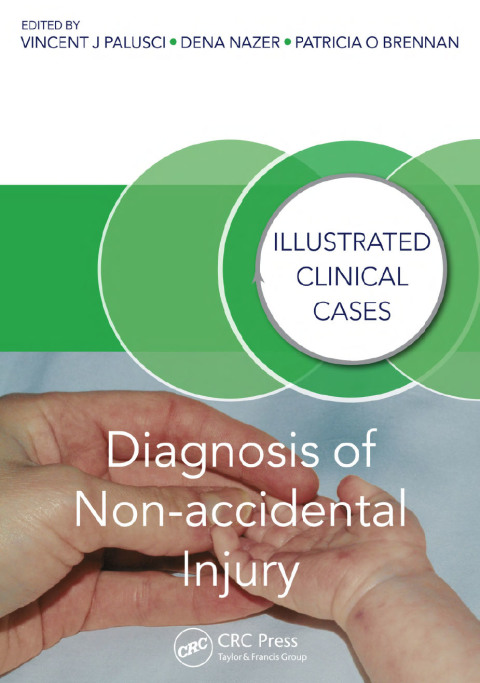 Cover image for book Diagnosis of Non-accidental Injury