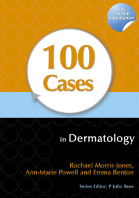 Titelbild: 100 Cases in Dermatology 1st edition 9781444117936