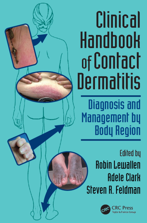 Clinical Handbook of Contact Dermatitis 