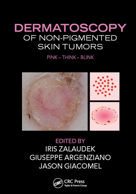 Cover image for book Dermatoscopy of Non-Pigmented Skin Tumors