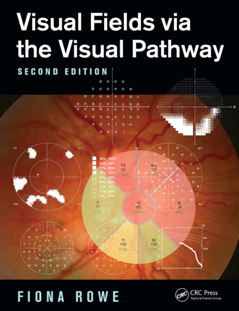 Cover image for book Visual Fields via the Visual Pathway