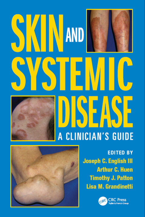Skin and Systemic Disease 