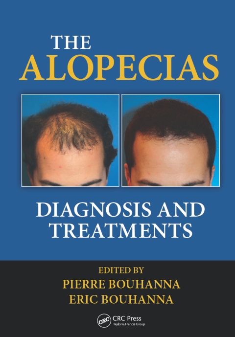 Cover image for book The Alopecias