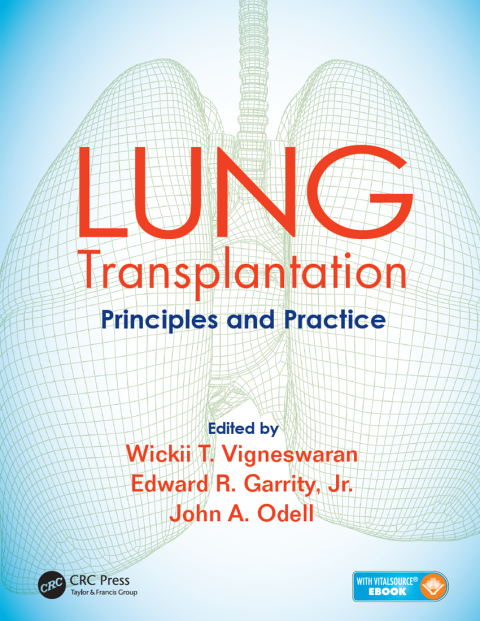Cover image for book Lung Transplantation