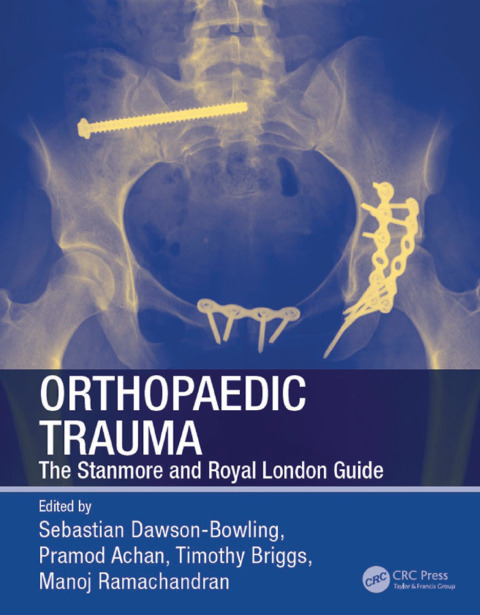 Cover image for book Orthopaedic Trauma