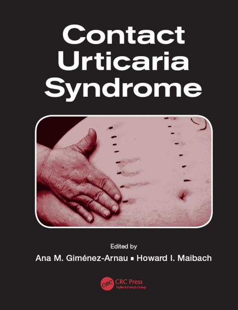 Cover image for book Contact Urticaria Syndrome