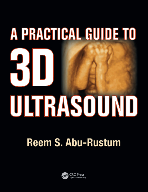 Cover image for book A Practical Guide to 3D Ultrasound