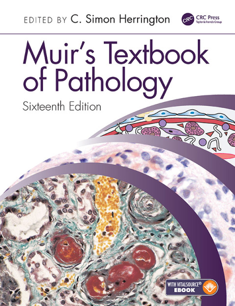 Cover image for book Muir's Textbook of Pathology