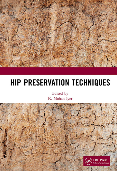 Cover image for book Hip Preservation Techniques