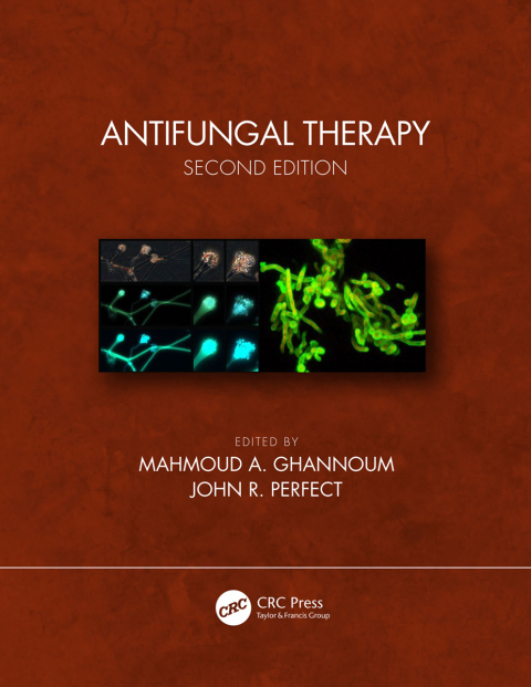 Cover image for book Antifungal Therapy