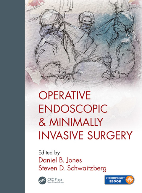 Cover image for book Operative Endoscopic and Minimally Invasive Surgery