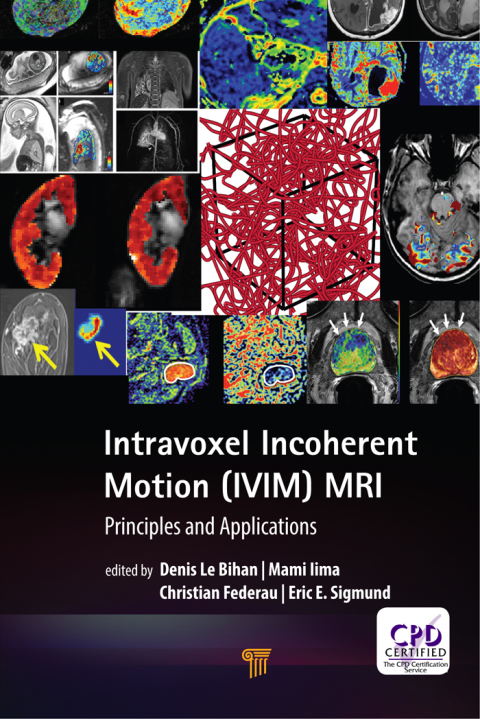 Cover image for book Intravoxel Incoherent Motion (IVIM) MRI