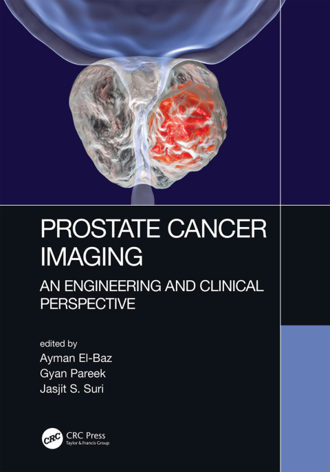 Cover image for book Prostate Cancer Imaging